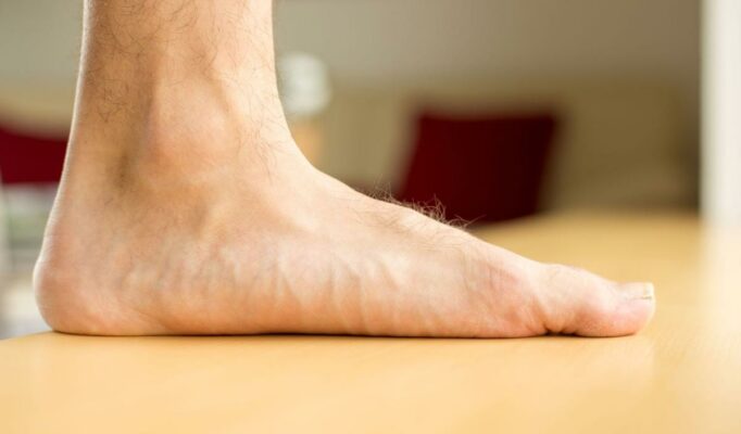 Płaskostopie podłużne - Leczenie w Warszawie