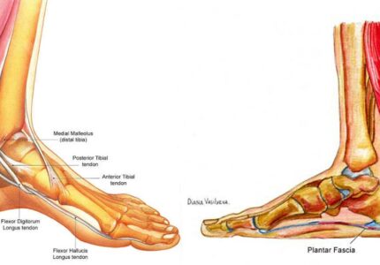 Diagnoza płaskostopia - Leczenie w Warszawie
