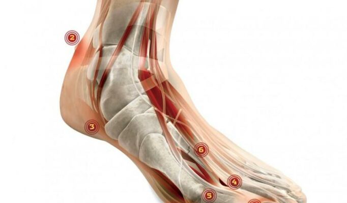 Stopa Mortona - Leczenie w Warszawie
